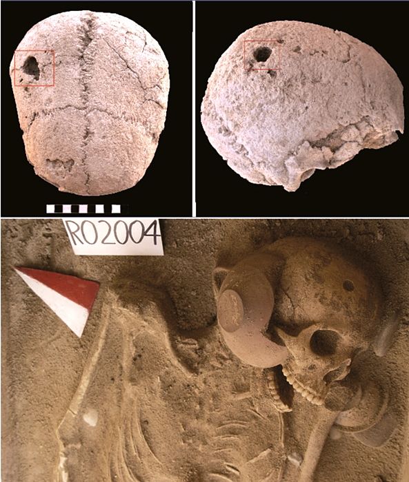 Part. dello scheletro e del cranio della ragazza di 19-21 anni con segni di perforazione chirurgica - Image by Soprintendenza Archeologica di Palermo