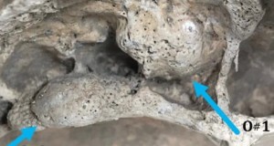 Cancro, malattia antichissima. La scoperta in Sicilia su un cranio del V-VI sec. d.C.