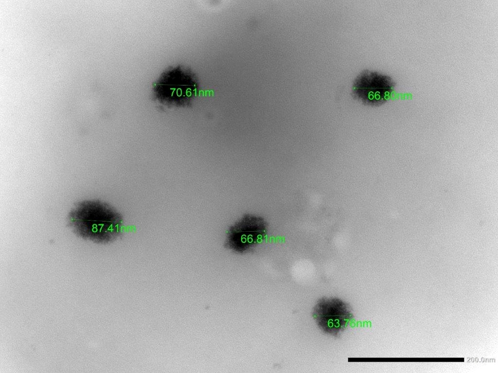 Virus al microscopio elettronico